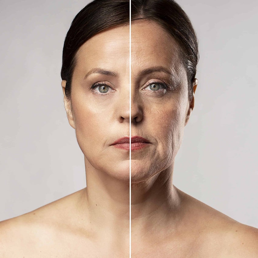 HIFU Facial - Lifting sin cirugía Rostro Completo ó HIFU Facial - Lifting sin cirugía Zonas del Rostro