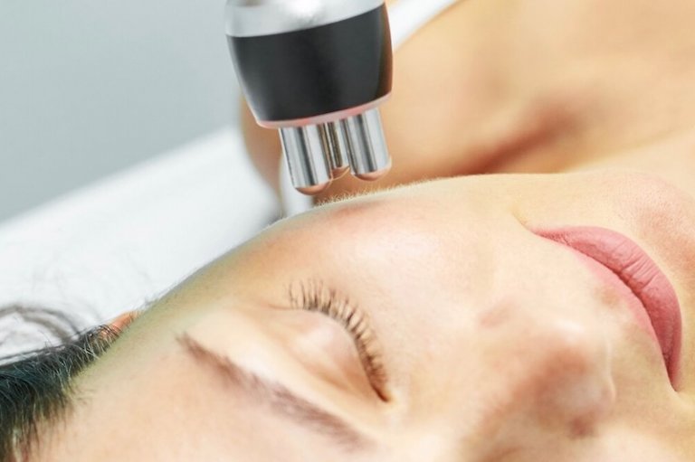 Tensor Facial Radiofrecuencia