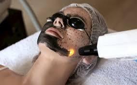 Hollywood Peel Facial
